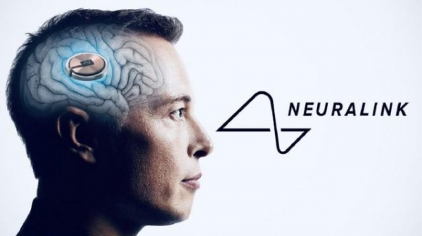 Чип Neuralink вживят второму пациенту